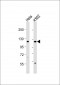 DDX11 Antibody (C-term)